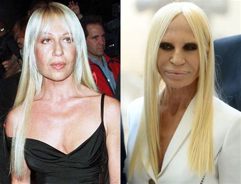 donatella versace foto|donatella versace before and after.